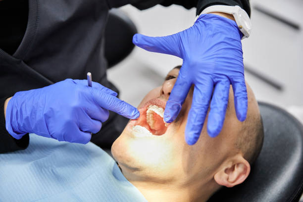 Best Emergency Dental Care for Broken or Chipped Teeth in Walkerton, IN